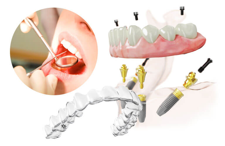 予防歯科と高度歯科治療
