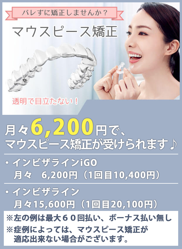 マウスピース矯正についてはこちら